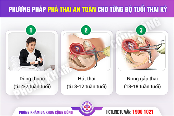 Tư vấn phá thai theo tuần tuổi thai – đảm bảo an toàn không biến chứng
