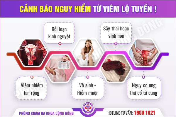 Chị em truyền tai nhau địa chỉ có bác sĩ khám chữa viêm lộ tuyến giỏi ở Hà Nội