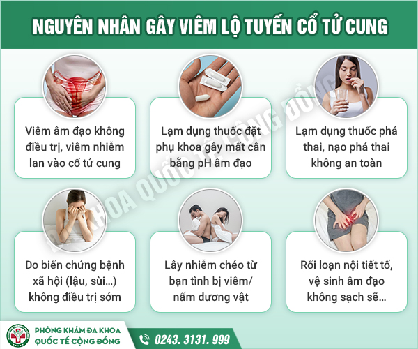 [Cảnh báo] Nguyên nhân tác hại của viêm lộ tuyến- Ai chưa rõ phải đọc NGAY!